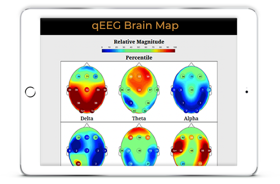 qEEG Brain Mapping Database Neurofeedback - Tablet 
